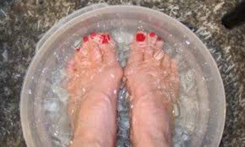 Isvatten för att behandla nageltrång