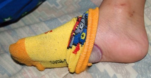 4 fördelar med att sova med lök på fötterna