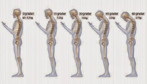 6 vanor som orsakar nacksmärta och ryggproblem