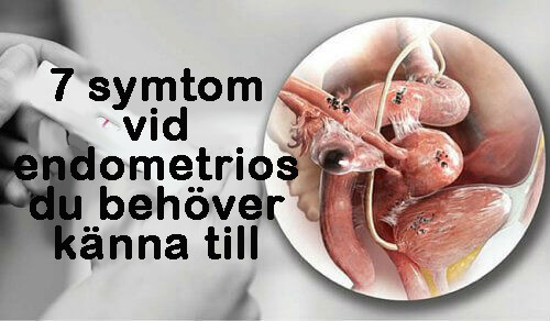 7 symtom på endometrios du behöver känna till