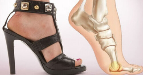 5 fördelar med att sluta bära högklackade skor