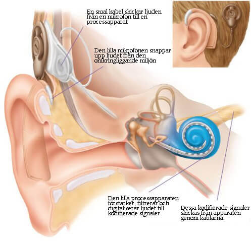 Hur hörseln fungerar
