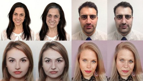 10 negativa effekter av stress på ditt utseende