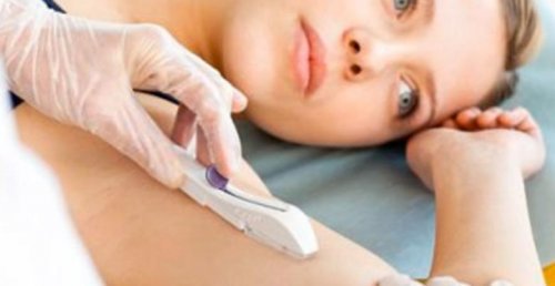 hormonimplantat på armen