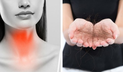 8 saker som bekämpar sköldkörtelrelaterat håravfall