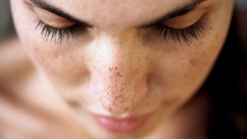 6 naturliga kurer för att bli av med svarta fläckar i ansiktet