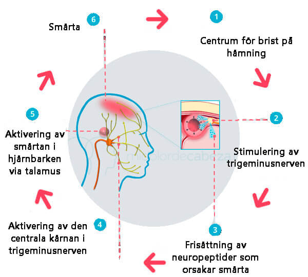 symtom vid migrän