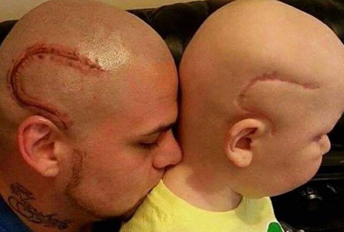 "Nu är vi likadana." Pappan tatuerade sonens cancerärr