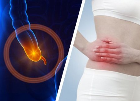 Tecken och symptom på appendicit