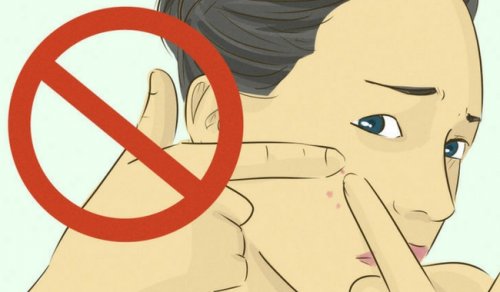 Att klämma finnar kan leda till livslånga problem