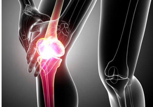 Tendinit är inflammation