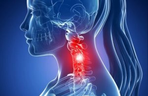 cervikal spondylos; symptom och naturliga behandlingar