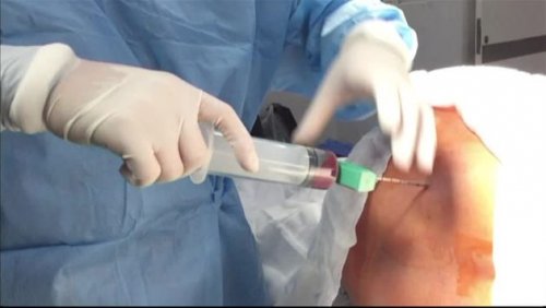 Läkare utför ingrepp