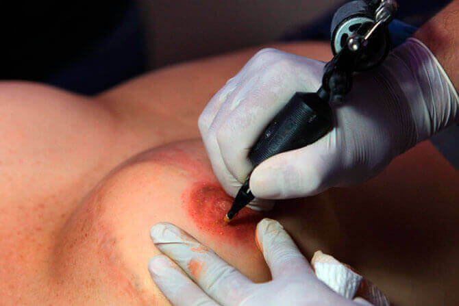 Ta tillbaka din självkänsla med en tatuering