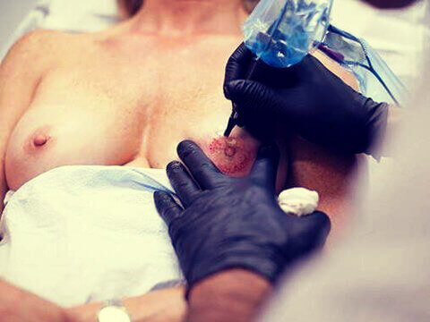 En tatuerare som gör en väldigt speciell tatuering