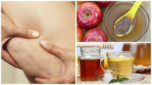 Bekämpa celluliter med honung och äppelcidervinäger