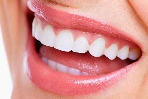 Vita tänder