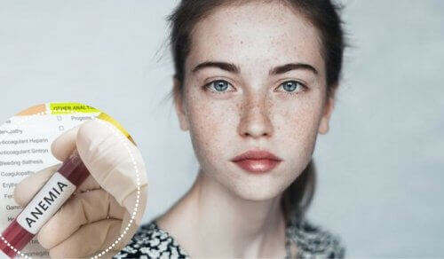 Kan anemi ha en påverkan på dina känslor?