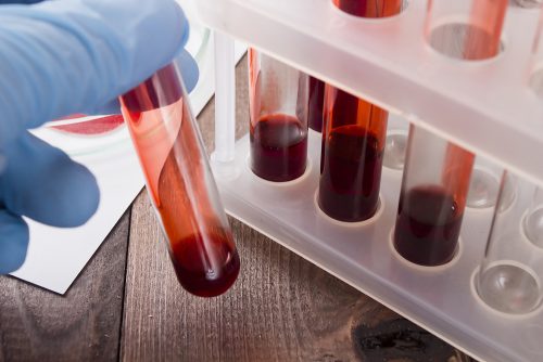 Vi kan komma att upptäcka cancer tidigt med ett blodprov