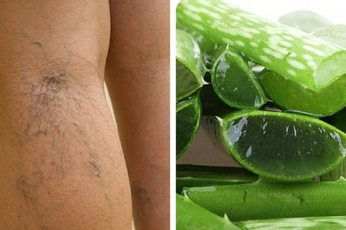 Stimulera cirkulation med aloe vera