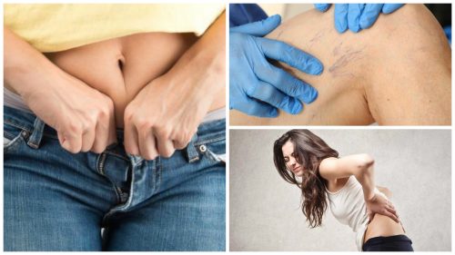 9 problem som kan uppstå av åtsittande kläder