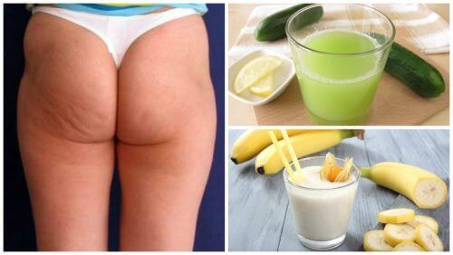 Minska dina celluliter med 6 naturliga behandlingar Minska dina celluliter med 6 naturliga behandlingar