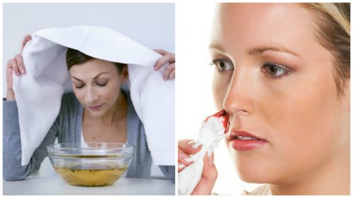 7 effektiva lösningar för att stoppa näsblod