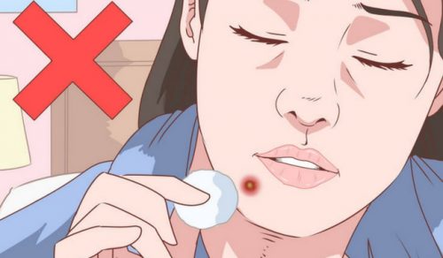 Effektiv, naturlig behandling för akne på hakan