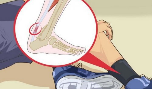 5 intressanta kurer för hälseneinflammation