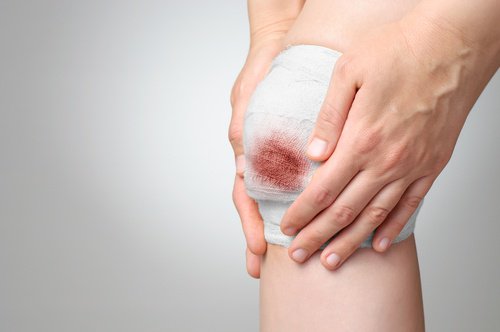 knä med bandage