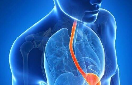 10 konstiga symptom på gastroesofageal refluxsjukdom