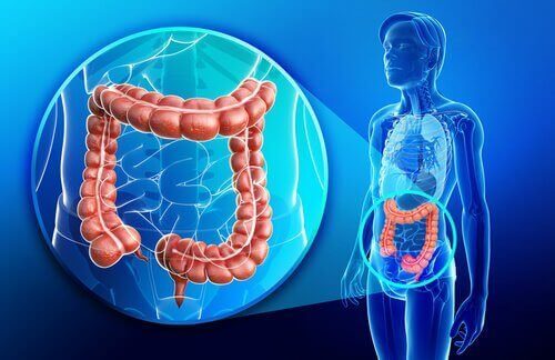 Vad är egentligen Crohns sjukdom?