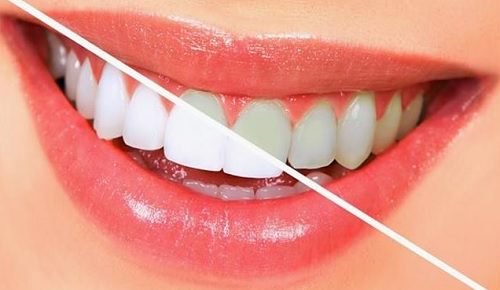 10 livsmedel som gör tänderna vitare naturligt
