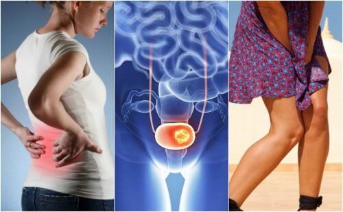 7 tecken på blåscancer att hålla utkik efter