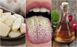 Hur man kontrollerar candida med 5 naturliga kurer