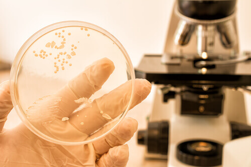 Provtagning för candidiasis