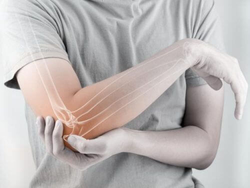 Lindra din tennisarmbåge med 5 naturliga kurer