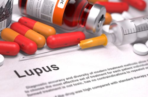 Piller för lupus