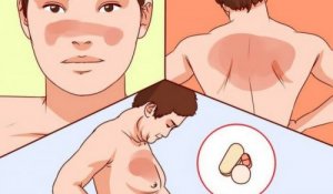 Viktiga saker du bör veta om lupus