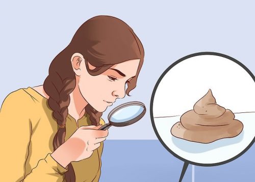 Vad form och färg på bajset säger om din hälsa