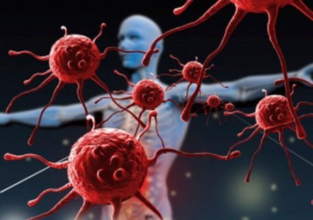 Försvagat immunförsvar