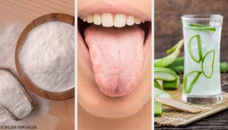 Beläggning på tungan: 8 naturliga kurer