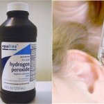 Väteperoxid