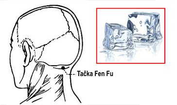 Bakhuvud illustration