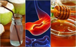 Prova dessa fantastiska naturliga huskurer mot gastrit