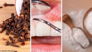Inflammerat tandkött: naturliga kurer som fungerar