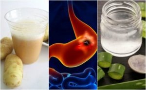 5 huskurer för att läka magsår snabbare