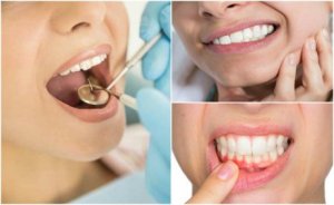 Tandinfektioner: 7 symptom du bör känna till