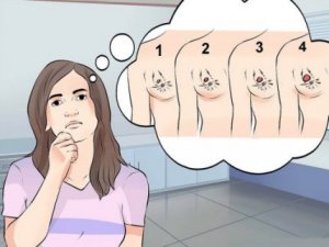 De olika typerna av bröstcancer: symptom & behandling