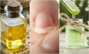 5 naturliga huskurer för att fixa svaga naglar